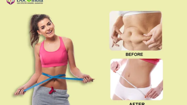 Liposuction Clinic | Surgery Cost in Hyderabad – Docplus India