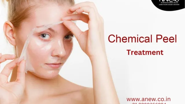 Chemical Peel Treatment Cost In Bangalore And Goa At Anew