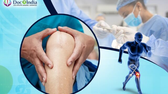 Knee Replacement Surgery In Bangalore At Docplus India